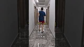 102 cm on Femurs Achieved Tibia Next 17 cm Height Increase Goal [upl. by Zul393]