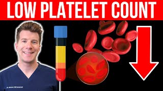 Doctor explains LOW PLATELET COUNT Thrombocytopenia  Causes symptoms and more [upl. by Daeriam]