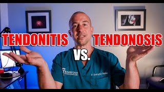 Hamstring Tendonitis vs Tendonosis What You NEED To Know [upl. by Feliza]