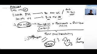 Primary sclerosing cholangitis [upl. by Alleen]