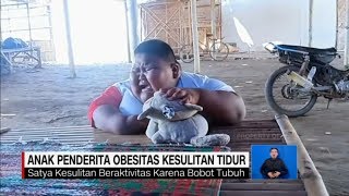 Kasihan Anak Penderita Obesitas Ini Kesulitan Tidur [upl. by Aryhs98]