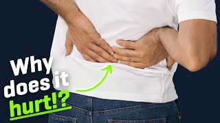 Understanding Sciatica Symptoms Causes and Treatment Options [upl. by Kannan]