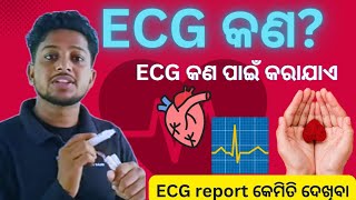 Electrocardiographକଣ  କଣ ପାଇଁ କରାଯାଏ How ECG done  ECG report heart ❤️ rate  ECG graph [upl. by Nueovas]