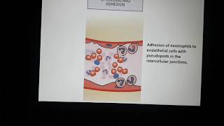 Acute inflammation 4 Cellular events exudation of leucocytes [upl. by Hollah]