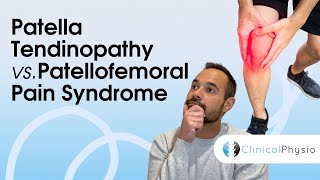 Patella Tendinopathy vs Patellofemoral Pain Syndrome  Expert Physio Guide [upl. by Castara298]