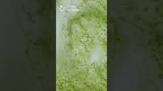 Anabaena azollae en cavidad foliar de Azolla sp Corte a mano [upl. by Nela]