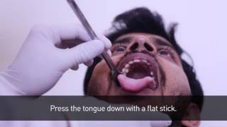 Healthcare Throat Swab Collection Procedure [upl. by Amalbena16]