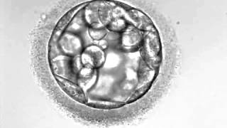 Development of hatching Embryo blastocyst stage [upl. by Teik465]