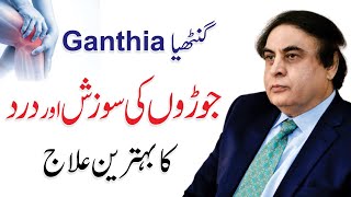 Ganthiya Ka Ilaj  Arthritis Symptom amp Treatment UrduHindi  By Dr Khalid Jamil [upl. by Teage419]