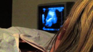 IVF diary  9  IVF the secret cycle  Embryo Transfer IVF [upl. by Templer]