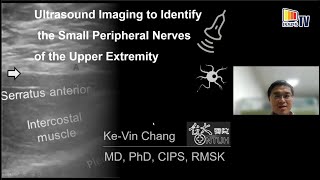 Ultrasound Imaging to Identify the Small Peripheral Nerves of the Upper Extremity [upl. by Aicac973]