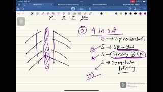 Medullary Syndrome Neurology04 FCPS Part01 Batch Whats App 01878342090 [upl. by Saunder372]