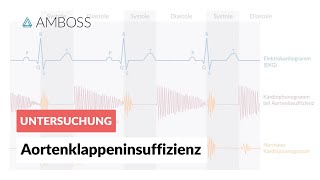 Aortenklappeninsuffizienz  Herzgeräusch  AMBOSS Video [upl. by Essinger879]