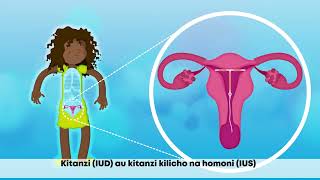 Is nonhormonal contraceptive better than a hormonal one Learn how It Works and What to Expect [upl. by Adnolahs]