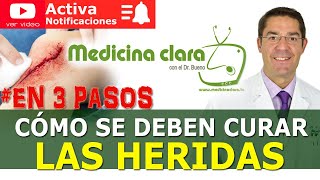 CURAR HERIDAS 🩸 3 PASOS SENCILLOS 👨‍⚕️ ¿Dejar herida tapada o al aire  Medicina Clara [upl. by Close526]