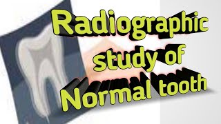 Radiographic study of normal tooth  Radiopaque and Radiolucent Basic of radiograph of tooth struc [upl. by Vassell]