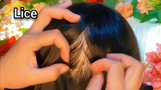 ASMR Satisfying I will help remove your fleas  No Talking 😴💤🥱 [upl. by Ynnub69]