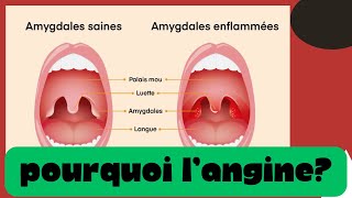 Pourquoi tu as l’angine  Douleur à la gorge et le traitement [upl. by Alysa]