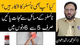 Tonsillitis SymptomsCauses And Treatment In Urdu  Gale Ke Tonsils k ilaj [upl. by Atiuqam]