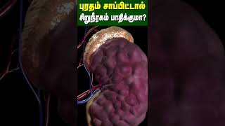 புரதம் சாப்பிட்டால் சிறுநீரகம் பாதிக்குமா  Does eating protein affect the kidney  Dr Arunkumar [upl. by Lawford]