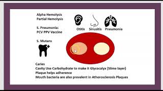 Quels sont les causes du RAA  ASLO Cardite Sydenham Angine Rhumatisme Articulaire Aigu 3 Minutes [upl. by Wendy]