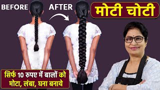 रूखे सूखे बेजान बालों में भी डाल देगा एक नई जान  100 नए बाल उगाएँ  DIY Powerful Hair Growth Serum [upl. by Branch]