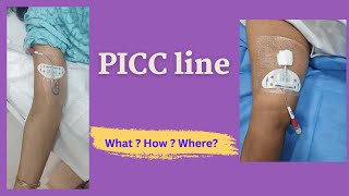 PICC Line Insertion  Patient Education video [upl. by Zeni]