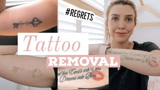 Laser Tattoo Removal  Full Experience [upl. by Reta213]