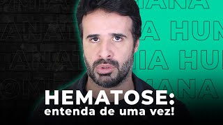 HEMATOSE ENTENDA DE UMA VEZ ATRAVÉS DE UMA ANATOMIA SIMPLIFICADA [upl. by Gney496]