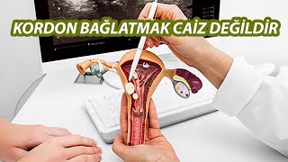 Kordon Bağlatmak Caiz Değildir  İbrahim Zeren [upl. by Volkan]