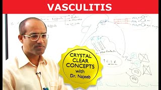 Vasculitis  Causes Symptoms amp Treatment [upl. by Irahcaz]