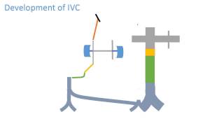 Inferior vena cava development [upl. by Ebocaj]