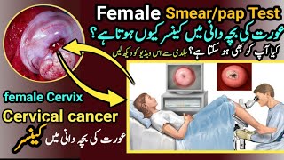 pap smearpap Test performedcervical cancer in females uteruspower [upl. by Elledoj]