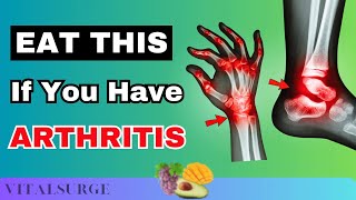 Top 10 Fruits If You Have Arthritis Eat Now [upl. by Ailasor889]