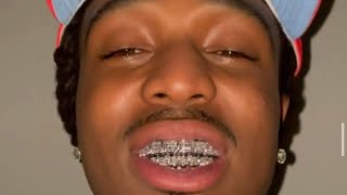 Quavo Teeth 🦷 Without Grill 😳 [upl. by Deegan]