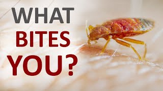 Guide to the bites how to identify what insects are biting you at your home [upl. by Neraa835]