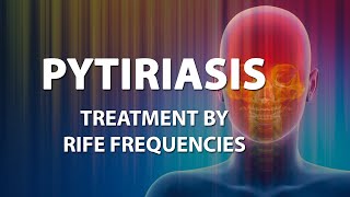 Pityriaris Tinea versicolor  RIFE Frequencies Treatment  Energy amp Quantum Medicine Bioresonance [upl. by Pironi]