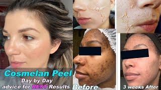 COSMELAN PEEL  Skin Expert SECRETS to CORRECT skin recovery and Best results2021 MUST WATCH [upl. by Atte]