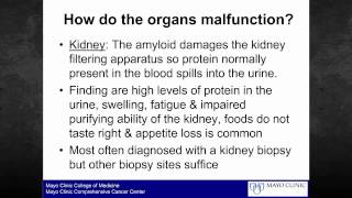 Amyloidosis Foundation patient webinar quotAmyloidosis 101quot [upl. by Oster]