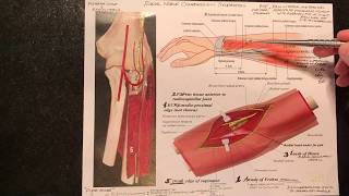 Radial Nerve Compression Syndromes Radial Tunnel Syndrome Wartenberg Syndrome [upl. by Sunshine764]