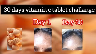 vitamin c tablet 30 days challange in tamil [upl. by Agler]