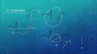 EKG Crashkurs Teil 1 Die absoluten Grundlagen [upl. by Smaoht]