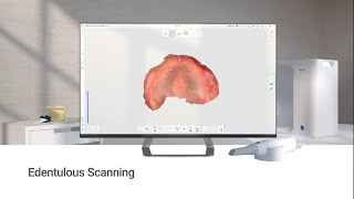 Edentulous Scanning [upl. by Rojas]