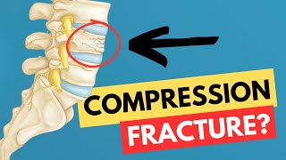 Compression Fracture How it happens what is it [upl. by Enaxor]