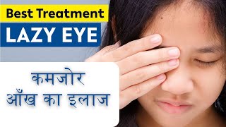 Lazy Eye Amblyopia Symptoms Causes amp Treatment कमजोर आँख का सही इलाज  Exercises for Lazy eye [upl. by Alesiram]