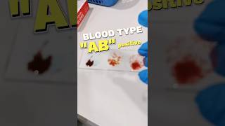 quotABquot positive blood type blood bloodgroup bloodtype bloodtyping laboratory [upl. by Akanke]