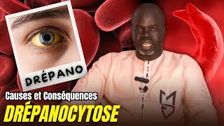 Drépanocytose P01  Causes et Conséquences   Pr Ousmane Ndiaye  LansarrTV [upl. by Yole]