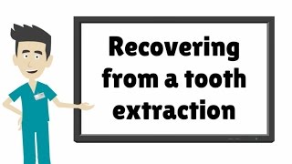 After Care For Tooth Extraction  What to Do After a Tooth Extraction [upl. by Agarhs]