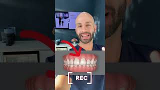 How can I fix my crooked front teeth and deep overbite Can Invisalign work [upl. by Roberts]