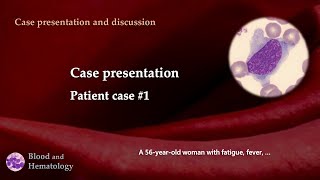 Patient case presentation case 1 [upl. by Irdua]